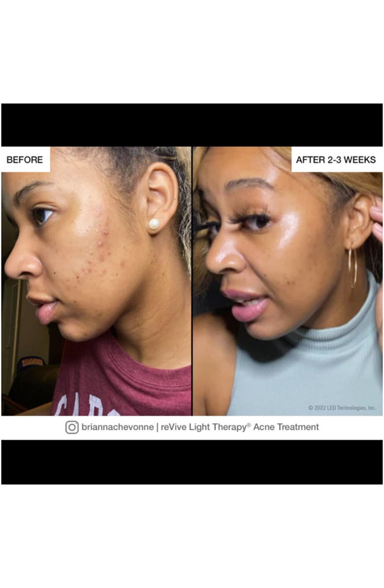 Second image of Lux Glo Portable LED Device