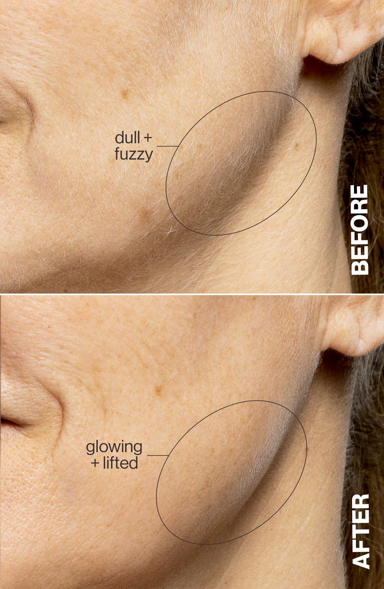 Second image of Anti-Aging Dermaplaning Tool