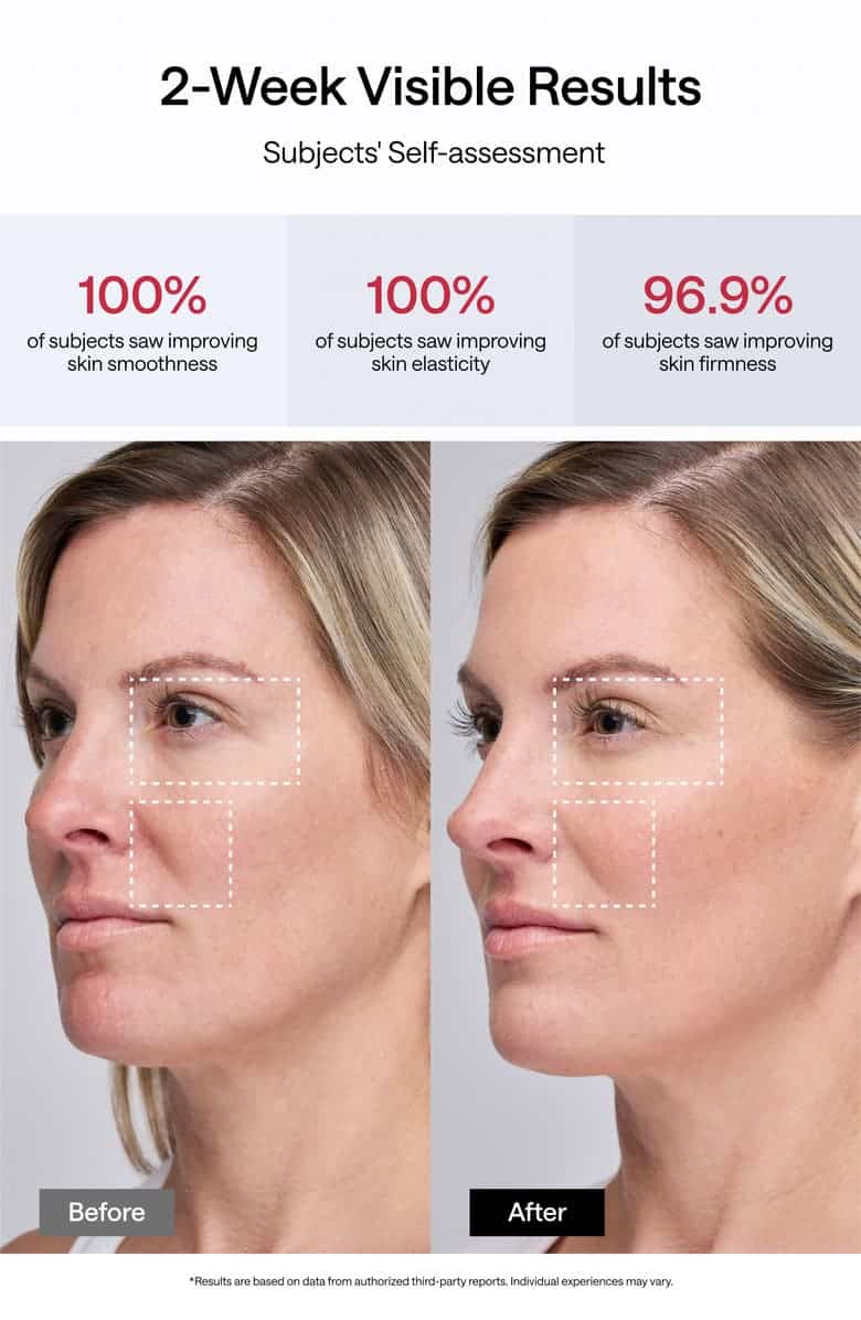 Second image of JMOON By Ulike UCollagen+ Microcurrent + LED Device