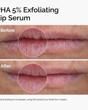 PHA-5-EXFOLIATING-LIP-SERUM-3.jpg